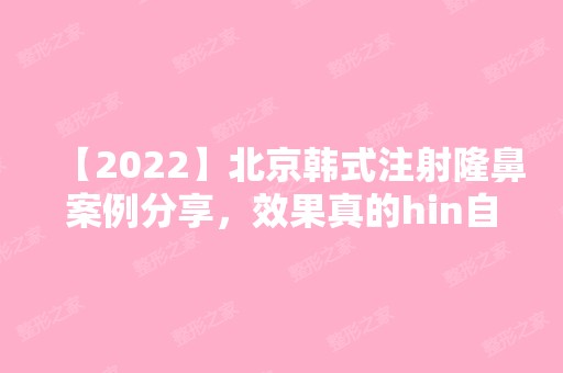 【2024】北京韩式注射隆鼻案例分享，效果真的hin自然！