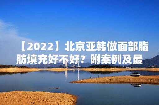 【2024】北京亚韩做面部脂肪填充好不好？附案例及新价格表！