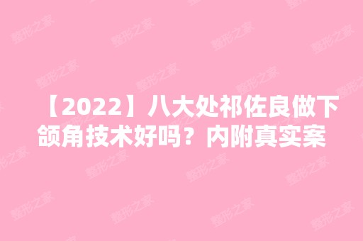 【2024】八大处祁佐良做下颌角技术好吗？内附真实案例和价格表