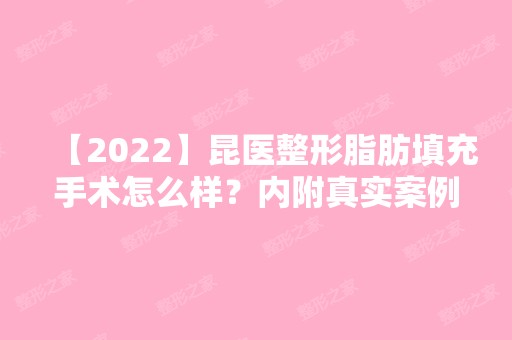 【2024】昆医整形脂肪填充手术怎么样？内附真实案例及前后对比~项目表参考