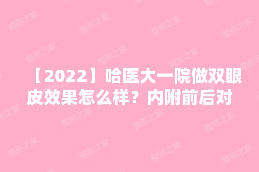 【2024】哈医大一院做双眼皮效果怎么样？内附前后对比~