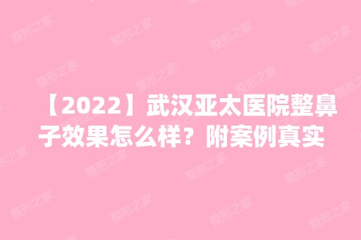 【2024】武汉亚太医院整鼻子效果怎么样？附案例真实恢复记录效果图_价格表参考