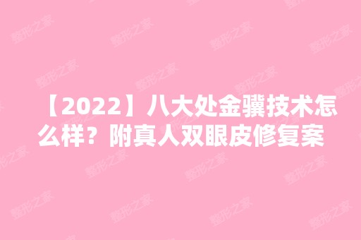 【2024】八大处金骥技术怎么样？附真人双眼皮修复案例展示及价格表