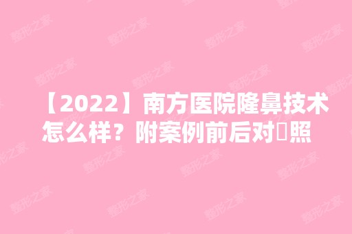 【2024】南方医院隆鼻技术怎么样？附案例前后对⽐照新价格表