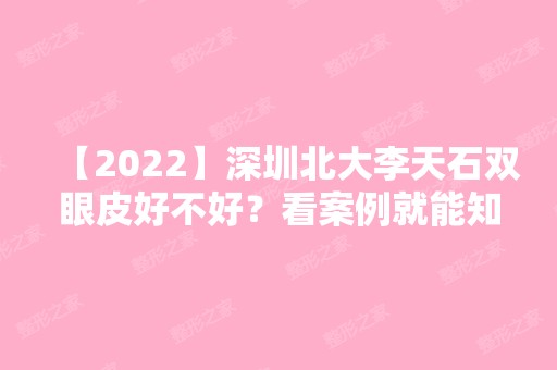 【2024】深圳北大李天石双眼皮好不好？看案例就能知道