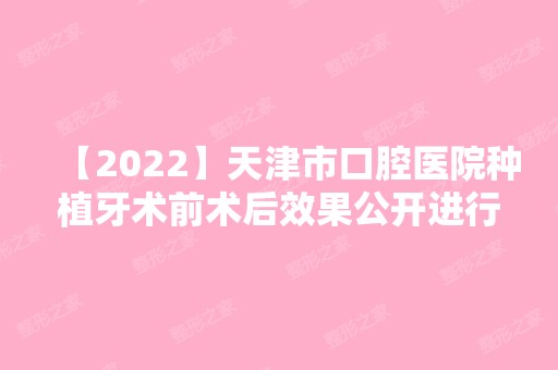 【2024】天津市口腔医院种植牙术前术后效果公开进行对比，效果看得见