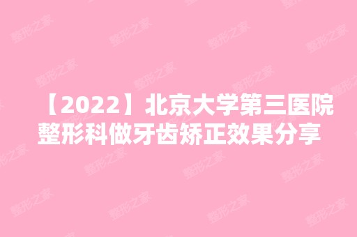 【2024】北京大学第三医院整形科做牙齿矫正效果分享，放心微笑