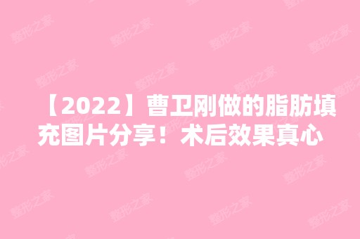 【2024】曹卫刚做的脂肪填充图片分享！术后效果真心不错！