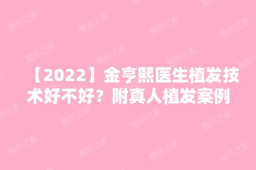 【2024】金亨熙医生植发技术好不好？附真人植发案例