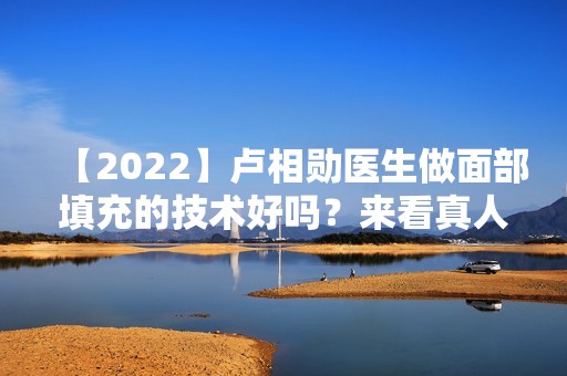 【2024】卢相勋医生做面部填充的技术好吗？来看真人做填充的对比图