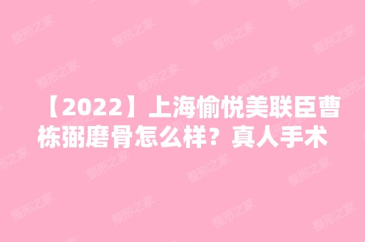 【2024】上海愉悦美联臣曹栋弼磨骨怎么样？真人手术过程实拍图