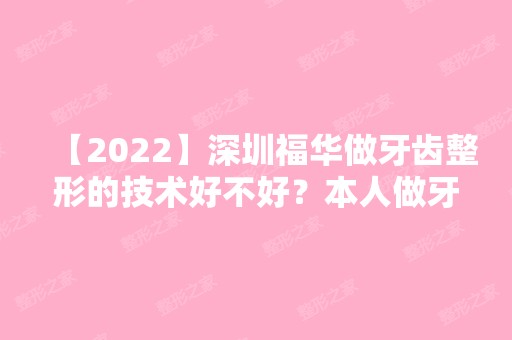 【2024】深圳福华做牙齿整形的技术好不好？本人做牙齿整形经历分享