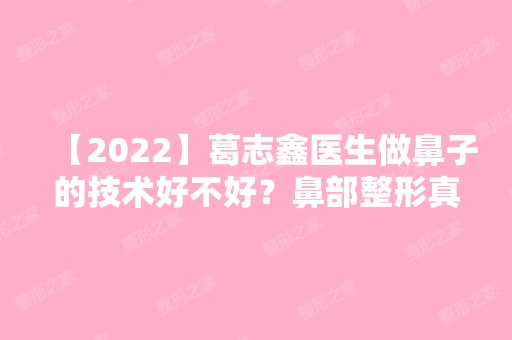 【2024】葛志鑫医生做鼻子的技术好不好？鼻部整形真人案例图分享