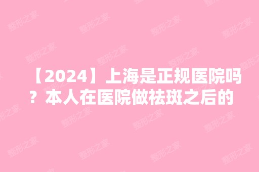 【2024】上海是正规医院吗？本人在医院做祛斑之后的效果分享给大家看