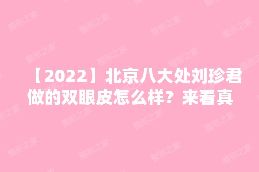 【2024】北京八大处刘珍君做的双眼皮怎么样？来看真实案例分享