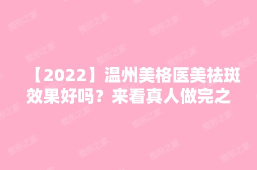 【2024】温州美格医美祛斑效果好吗？来看真人做完之后的实际效果吧