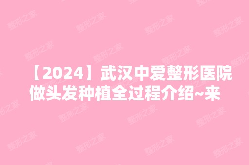 【2024】武汉中爱整形医院做头发种植全过程介绍~来看实际效果