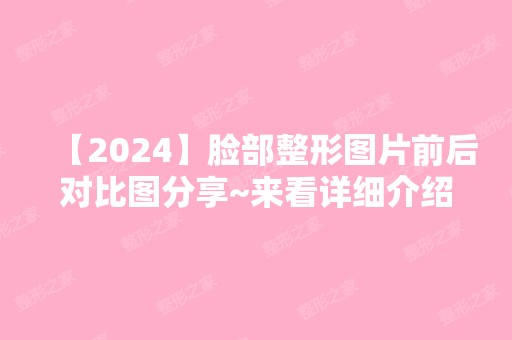 【2024】脸部整形图片前后对比图分享~来看详细介绍吧