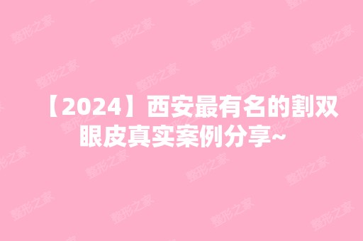 【2024】西安有名的割双眼皮真实案例分享~