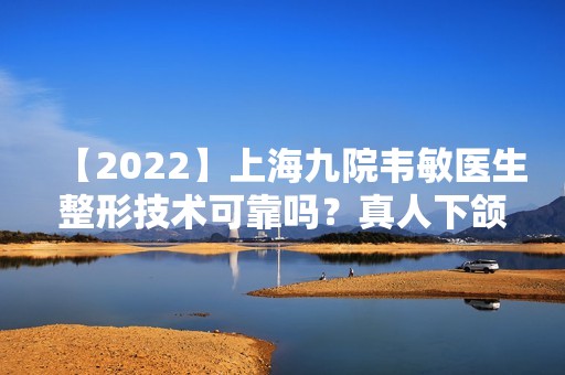 【2024】上海九院韦敏医生整形技术可靠吗？真人下颌角真实效果图