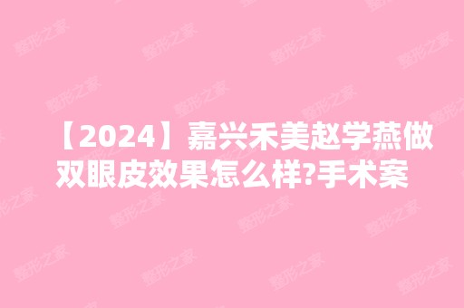 【2024】嘉兴禾美赵学燕做双眼皮效果怎么样?手术案例