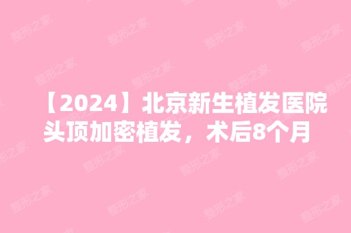 【2024】北京新生植发医院头顶加密植发，术后8个月效果图