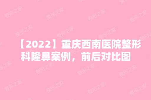 【2024】重庆西南医院整形科隆鼻案例，前后对比图