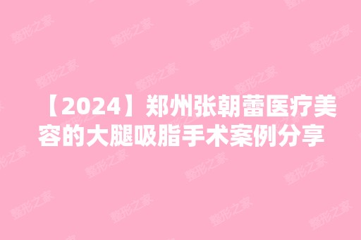 【2024】郑州张朝蕾医疗美容的大腿吸脂手术案例分享，附加王俊民医生介绍哦