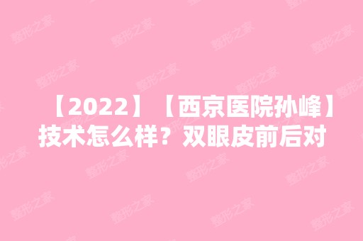 【2024】【西京医院孙峰】技术怎么样？双眼皮前后对比及价格明细查询