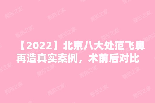 【2024】北京八大处范飞鼻再造真实案例，术前后对比！