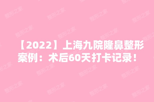 【2024】上海九院隆鼻整形案例：术后60天打卡记录！