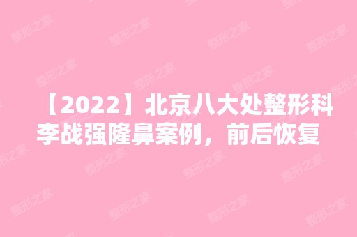 【2024】北京八大处整形科李战强隆鼻案例，前后恢复效果图