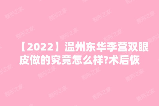 【2024】温州东华李营双眼皮做的究竟怎么样?术后恢复一个月效果自然