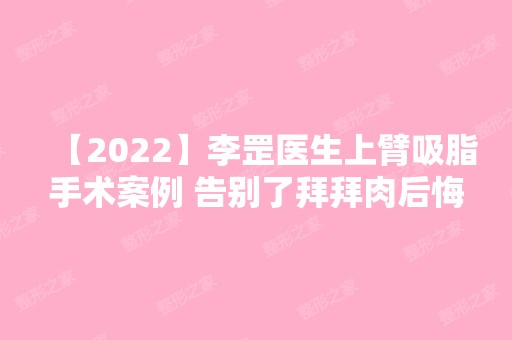 【2024】李罡医生上臂吸脂手术案例 告别了拜拜肉后悔没有早点做