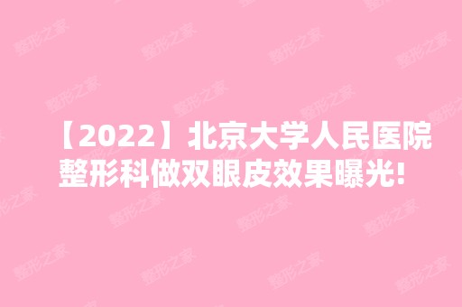 【2024】北京大学人民医院整形科做双眼皮效果曝光!看前后对比图