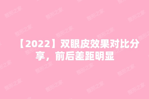 【2024】双眼皮效果对比分享，前后差距明显