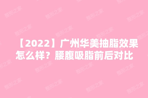 【2024】广州华美抽脂效果怎么样？腰腹吸脂前后对比照