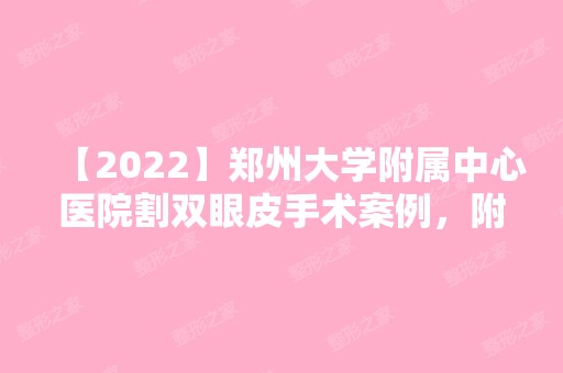 【2024】郑州大学附属中心医院割双眼皮手术案例，附术后效果图