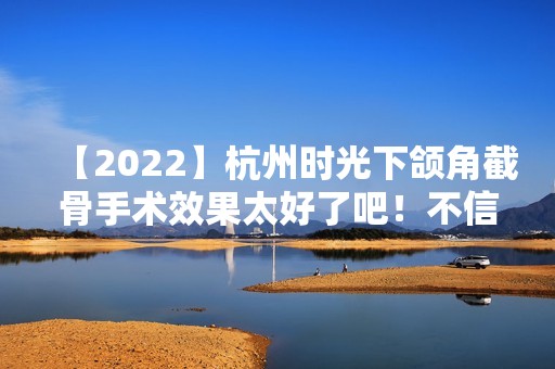 【2024】杭州时光下颌角截骨手术效果太好了吧！不信你来看图片对比吖！