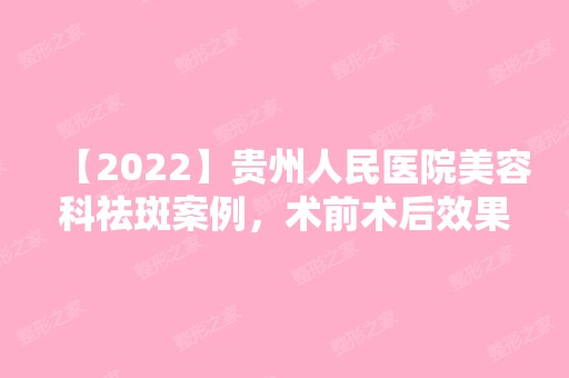 【2024】贵州人民医院美容科祛斑案例，术前术后效果大对比