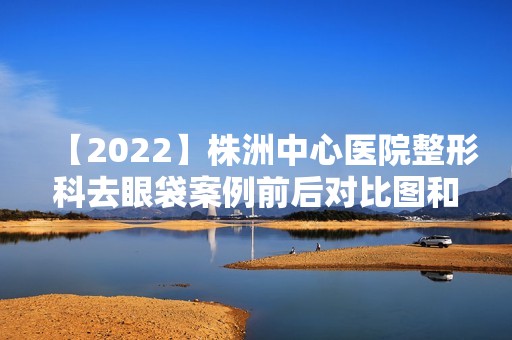 【2024】株洲中心医院整形科去眼袋案例前后对比图和手术经验分享