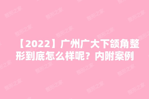 【2024】广州广大下颌角整形到底怎么样呢？内附案例及价格表明细一览！