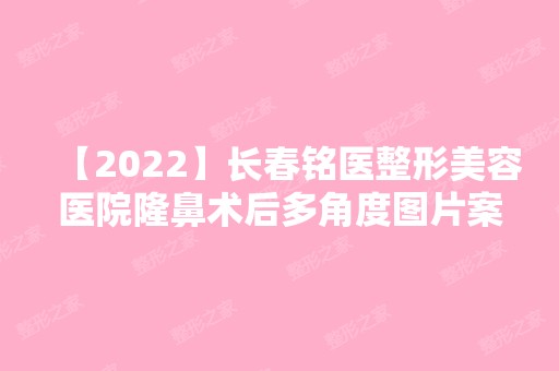 【2024】长春铭医整形美容医院隆鼻术后多角度图片案例分享，360度超自然