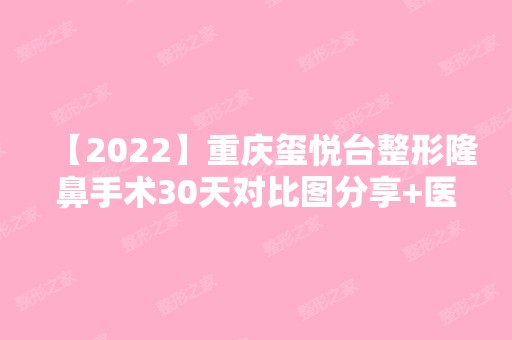 【2024】重庆玺悦台整形隆鼻手术30天对比图分享+医院介绍及预约