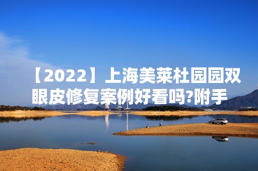 【2024】上海美莱杜园园双眼皮修复案例好看吗?附手术费用明细表