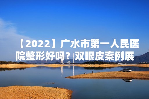 【2024】广水市第一人民医院整形好吗？双眼皮案例展示+整形价格明细查询