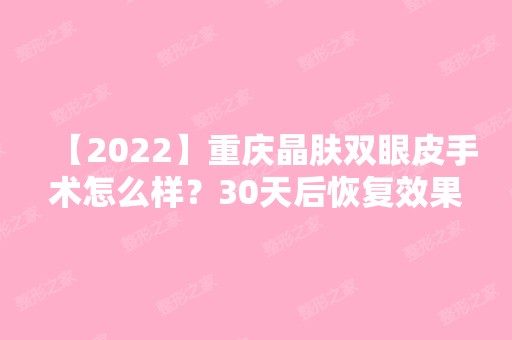 【2024】重庆晶肤双眼皮手术怎么样？30天后恢复效果对比图+新价格表参考