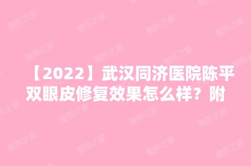 【2024】武汉同济医院陈平双眼皮修复效果怎么样？附双眼皮整形案例