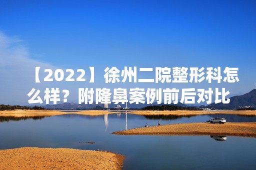 【2024】徐州二院整形科怎么样？附隆鼻案例前后对比图一览