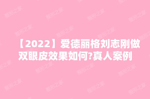 【2024】爱德丽格刘志刚做双眼皮效果如何?真人案例效果对比图分享